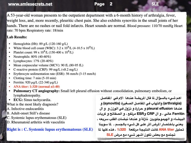 Systemic lupus erythematosus (SLE) - Smlesecrets